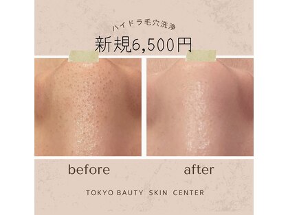 東京ビューティースキンセンター 五反田の写真