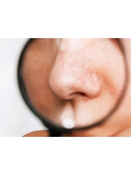 毛穴ケアをしたい