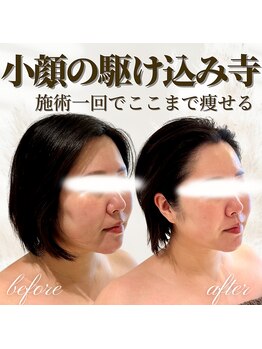 ミタメ 銀座店(MITAME)/とにかくボリュームダウンしたい