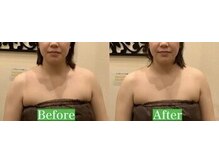 アジール 新潟市(agir)/Before/After画像