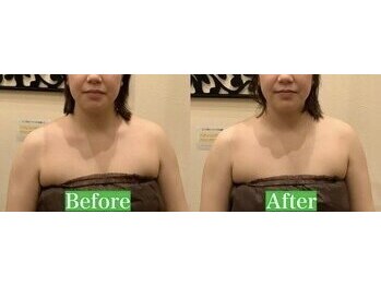 アジール 新潟市(agir)/Before/After画像