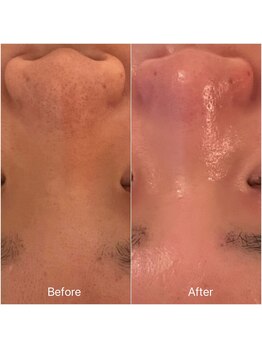 ミラー(MIRAOR)/毛穴・肌汚れ洗浄で水光白ツヤ肌