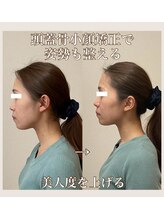 エレミュー 烏丸(Elemue.)/ストレートネック解消にも