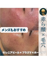 セレニア ボーテ(Selenia Beaute)/