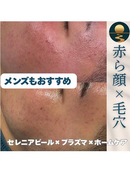 セレニア ボーテ(Selenia Beaute)/