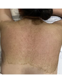 Olu【オル】肌質改善サロン. ハーブピーリング/クリスティーナ/ハーブリプロ