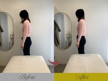 リン 大宮院(RIN)/骨膜整体での変化（担当：内田）