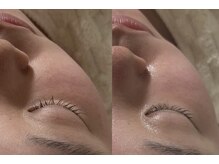 ナチュリー(Naturry)/小顔、弾力、水光肌へ。