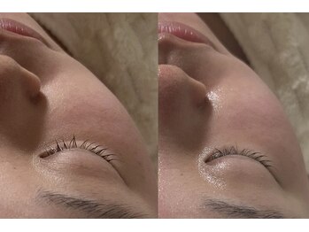 ナチュリー(Naturry)/小顔、弾力、水光肌へ。