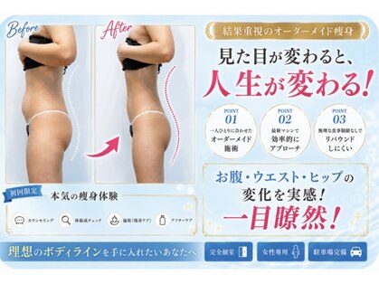 ルナ(Luna)の写真