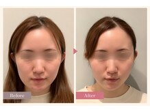 美容整骨小顔ラボの雰囲気（≪小顔・輪郭形成》顔幅・エラ張り・左右差・脂肪にアプローチ）