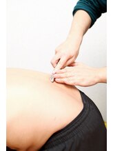 さがみはら整体院/頑固な硬さもカッサで解決！！