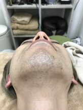 ナノハナ/鹿沼市全身脱毛の美容室ナノハナ