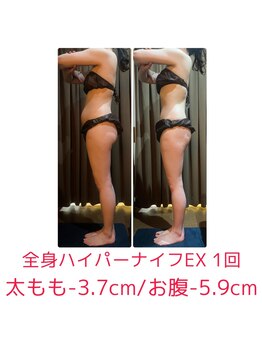 さとう美容整体 町田店/２０～６０代の方が通っています