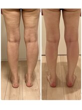 ルミノ 心斎橋(Rumino)/術後ケア