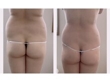 ミニョン(mignonn.)/