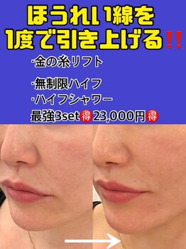 スペチアーレ 夙川/人気の金の糸