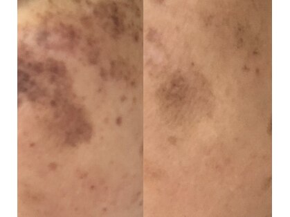 クレビア(CREBIA)の写真