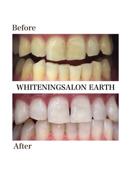 ルーナ 目黒(Luna)/食事制限なし