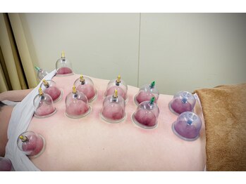 天華康整体院/カッピング(吸い玉)