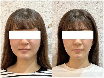 美容整体 ウェリナ 蟹江院/小顔矯正/骨盤矯正/痩身整体