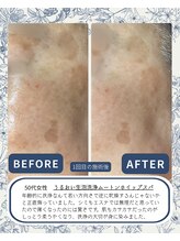 ≪毛穴洗浄肌質改善/小顔たるみケアSalon≫　泡のきもち【12/1 NEW OPEN（予定）】/美肌ケア
