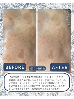 ≪毛穴洗浄肌質改善/小顔たるみケアSalon≫ 泡のきもち【12/1 NEW OPEN(予定)】/美肌ケア