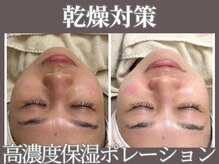 マヴィ 今福鶴見店(MavY.)/しっかり保湿！