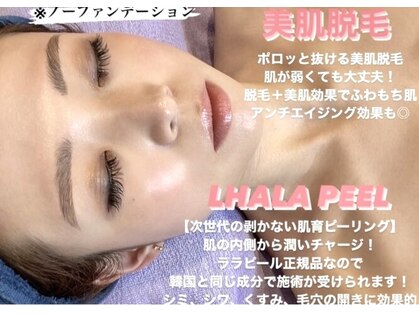 エンディミオン(Endymion)の写真