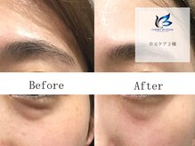 チェリーブロッサム 川越店(CHERRY BLOSSOM)/専門店の目元ケア♪