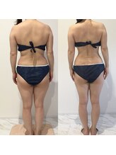 ビューティーサロン セガール(segar)/フォースカッターボディ