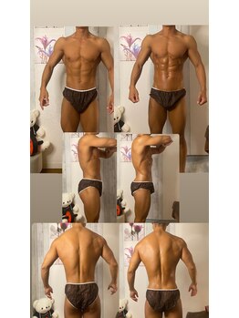 京橋メンズビューティーラボ(KMB LAB.)/ハイパーナイフのbefore/after