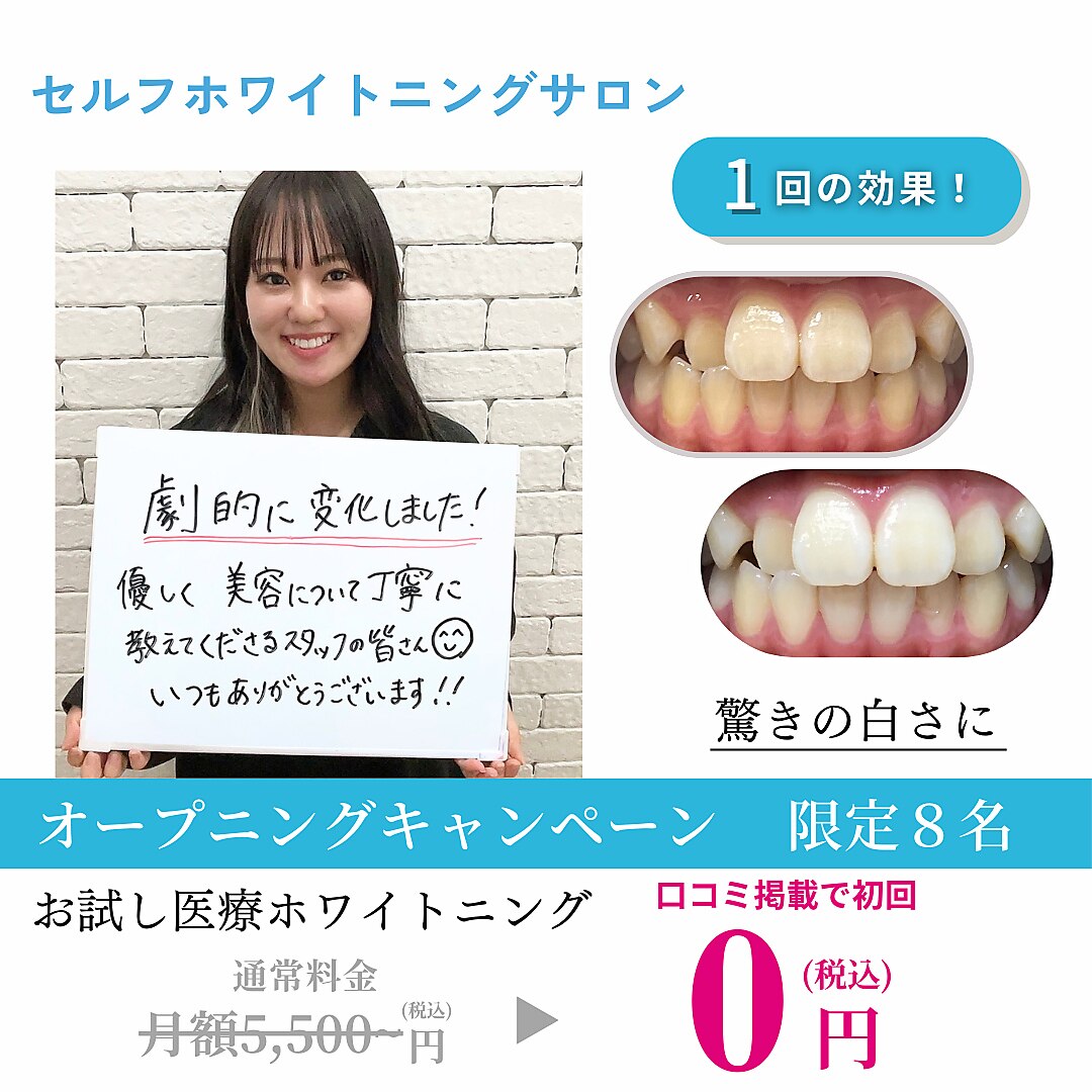 ※満員御礼につき受付終了【先着８名様】美白セルフホワイトニング\5,500→\0