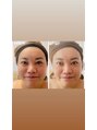ハパ(Hapa) エステティシャンの経験もあり、小顔矯正施術にも自信あり◎