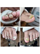 爪切り屋 足楽/