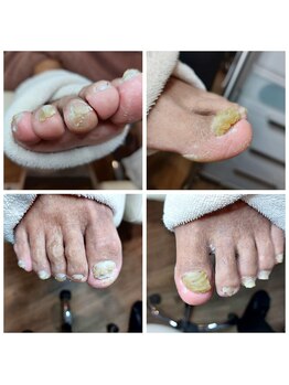 爪切り屋 足楽/