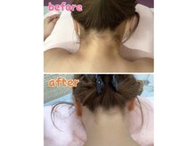 はうる.の雰囲気（【女性限定/1回限定】Ｓパーツ脱毛　¥7000→¥950）