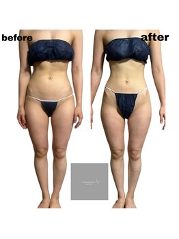 マロン(marron)/marron オリジナル痩身　