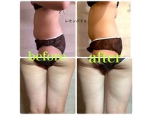 サロンドリマ(Salon de Lima)