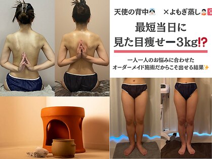 ミロン(miron)の写真