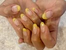 イエロー フレンチ