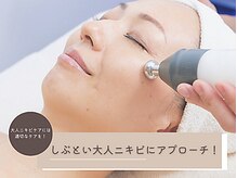 シーズ ラボ 立川店/洗顔と保湿で大人ニキビケア