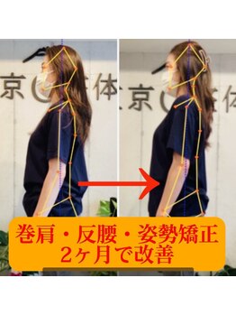 東京G整体/ビフォーアフター