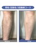 ☆メンズ脱毛☆夏前には足がツルツル♪足全脱毛3回コース　24000円⇒18000円