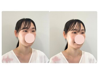 スタイルキューピット(style cupit)/メイクビフォアフター＊30代