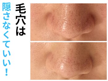 エリン(ERIN)/毛穴徹底洗浄