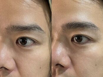 ワクシー 麻布十番店(WAXYYY.)/ハリウッドブロウリフト