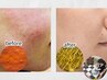 【お子さま同伴可】肌悩み別パック付体験メニュー90分