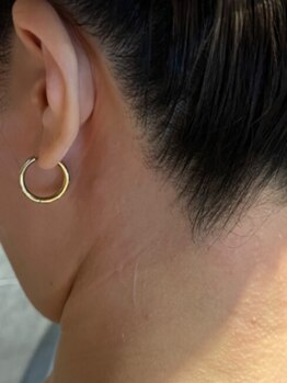 エット(ett)の写真/【お肌に優しい商材＆技法でつるすべ肌】国産WAX脱毛と美肌光脱毛のお店西鉄平尾近く☆