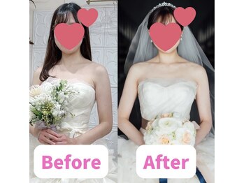 ボディキュア ブライダル美容整体 大阪梅田/自信も持って撮影に★/大阪/梅田